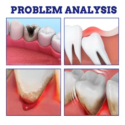 Toothcare Spray – Spray Away Oral Problems