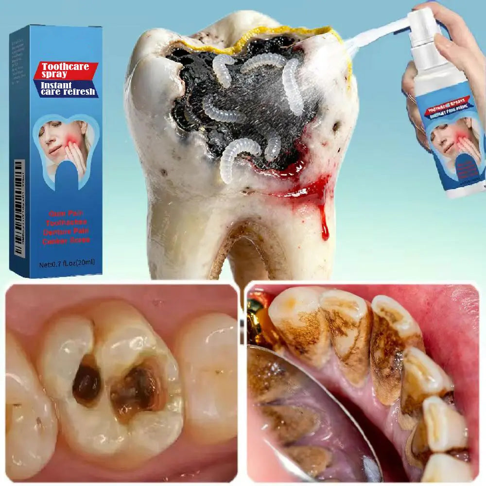 Toothcare Spray – Spray Away Oral Problems